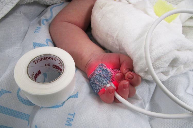 Ein Baby mit einem Gewicht von 500 Gramm zu operieren, ist schwer vorstellbar. Für Dr. José Morcate gehört das zum Arbeitsalltag.