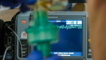defibrillator