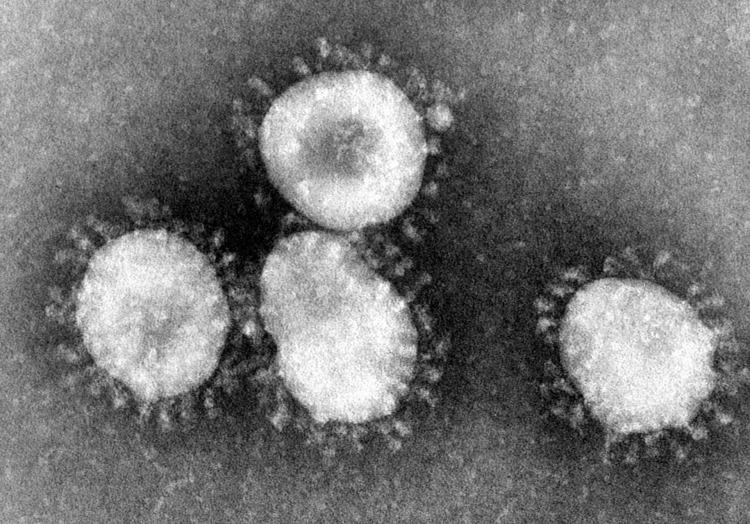 Coronavirus.