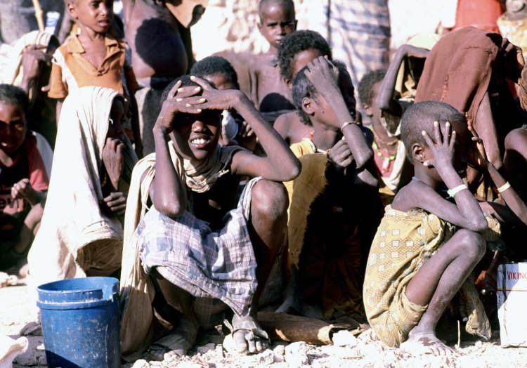 Hungernde Kinder in Somalia, über dts Nachrichtenagentur