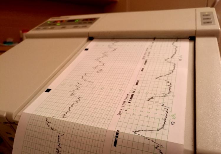 Kardiotokografie im Krankenhaus, über dts Nachrichtenagentur