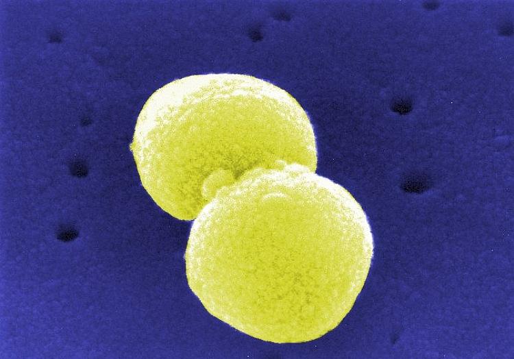 Streptococcus pneumoniae (Archiv), via dts Nachrichtenagentur